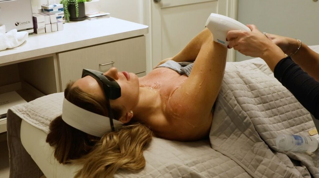 Young Female Getting bbl moxi laser treatment | Radiance Medical Spa in Coralville IA