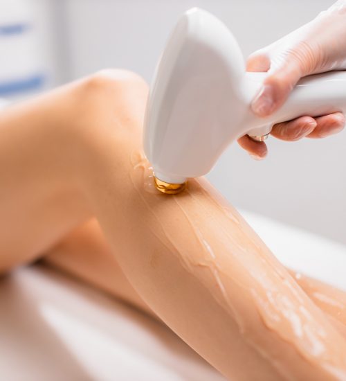 close-up woman's perfect legs while getting hair removal procedure in salon. professional beautician or cosmetologist use special ointment and apparatus. soft and smooth hairless skin on legs