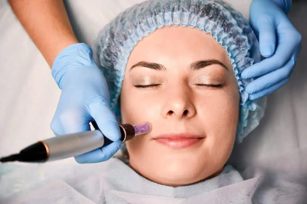 SkinPen Microneedling by Radiance Medical Spa LLC in Coralville, IA