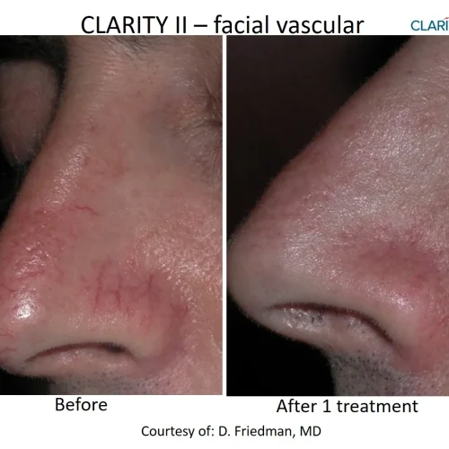 kjvhdsntzcngrrswdics