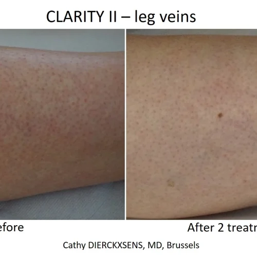 reawldf2edgj3ngpqwaw