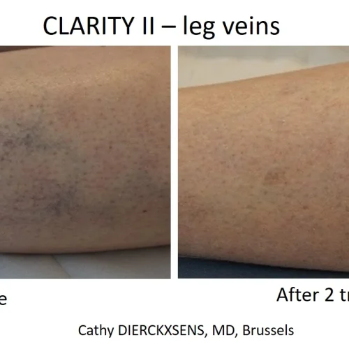 uos2qg6qocb2foojpwi9